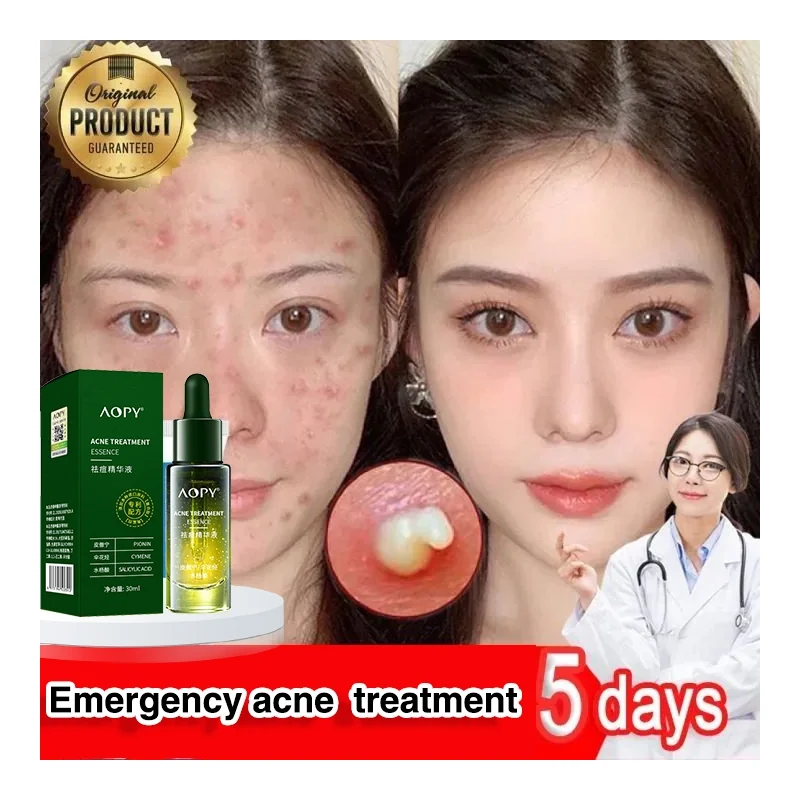 CLEAR IT ACNE/PIMPLE 30ML