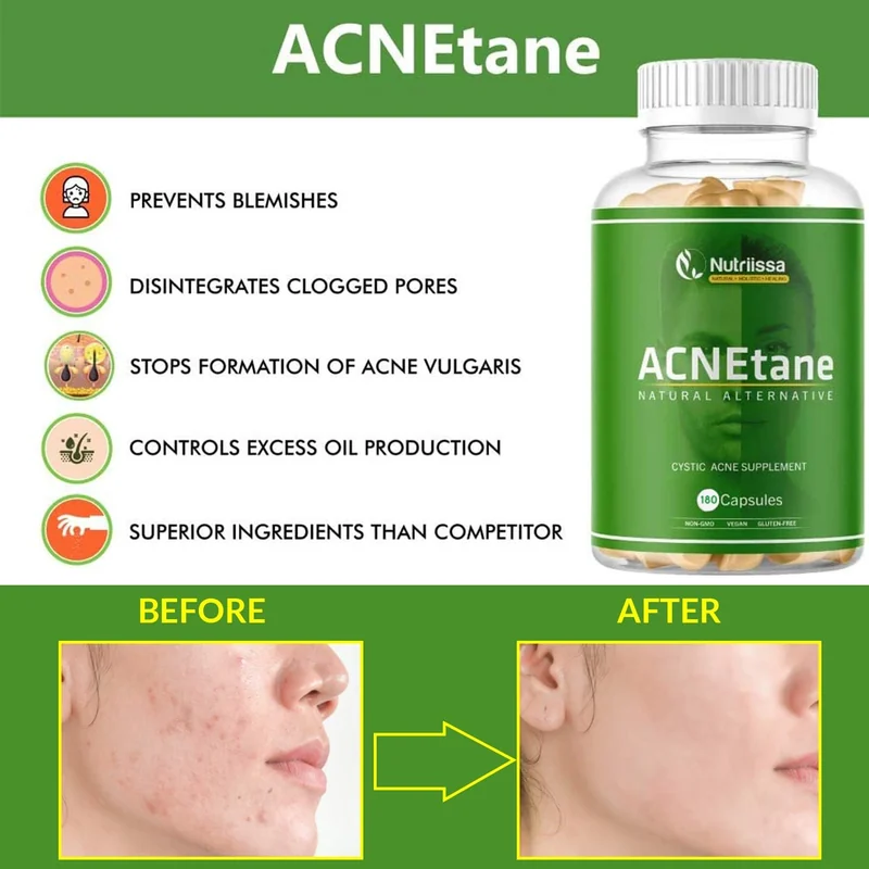 ACNETANE 20MG 1X1